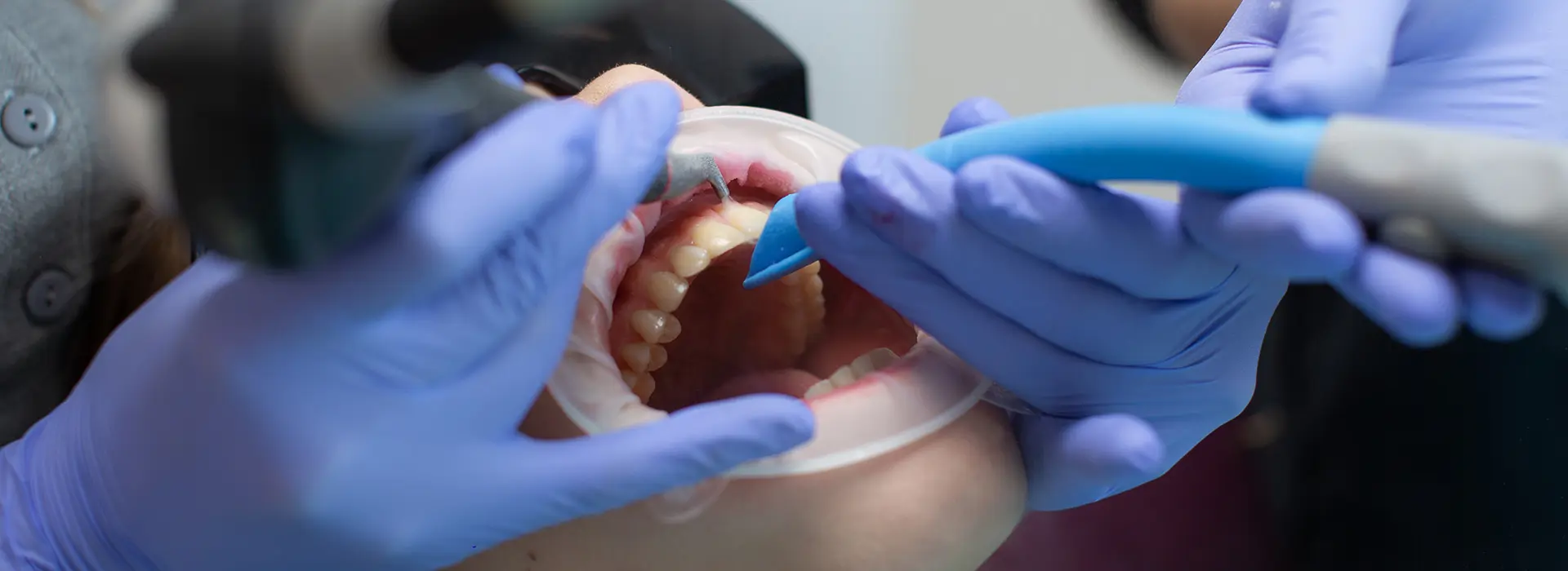 Beyond Brushing: Managing Your Dental Health with Chronic Conditions