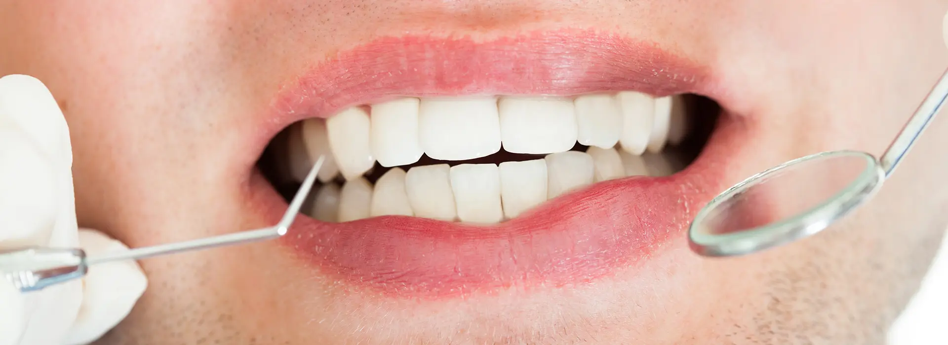 Why Dry Mouth Puts Your Teeth at Risk