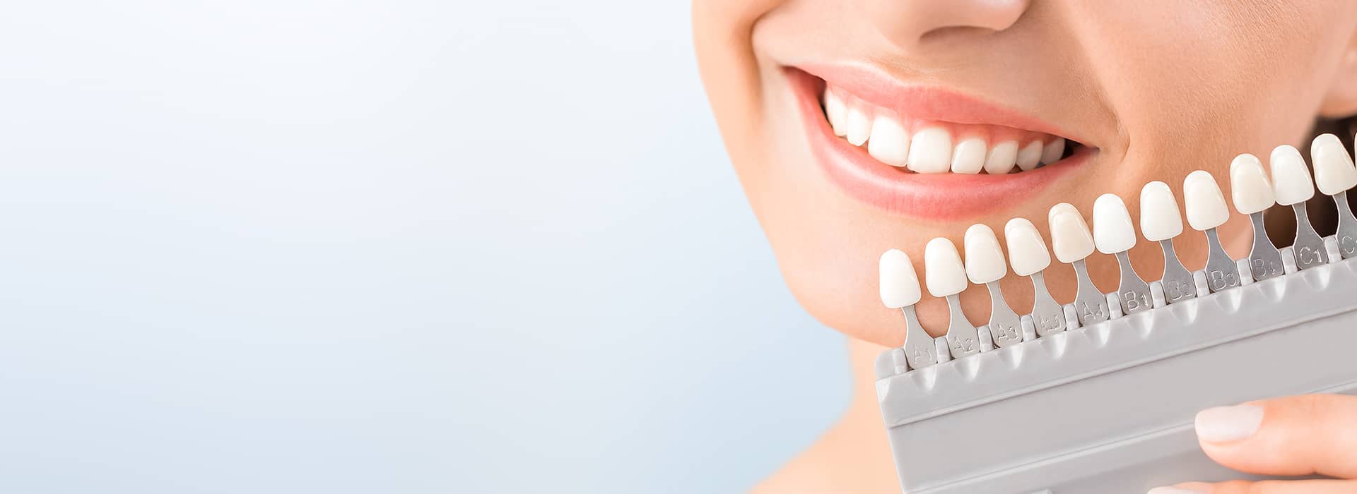 Porcelain Crowns, Veneers, and Bridges Dental Crowns Greeley CO