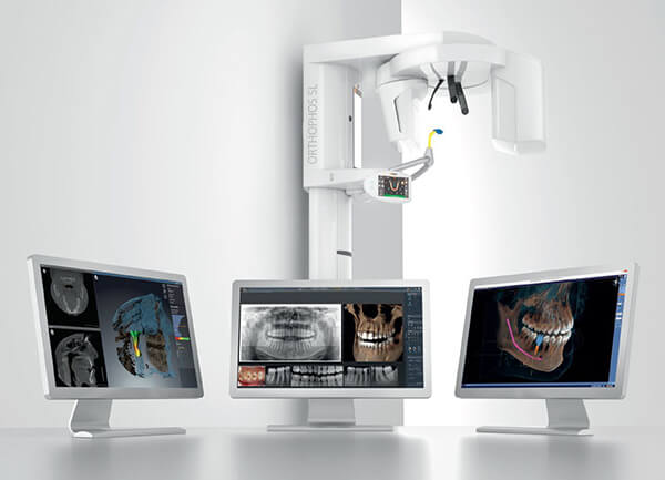 CBCT / 3D X-ray